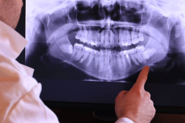 Best Urgent Tooth Repair  in Brevard, NC